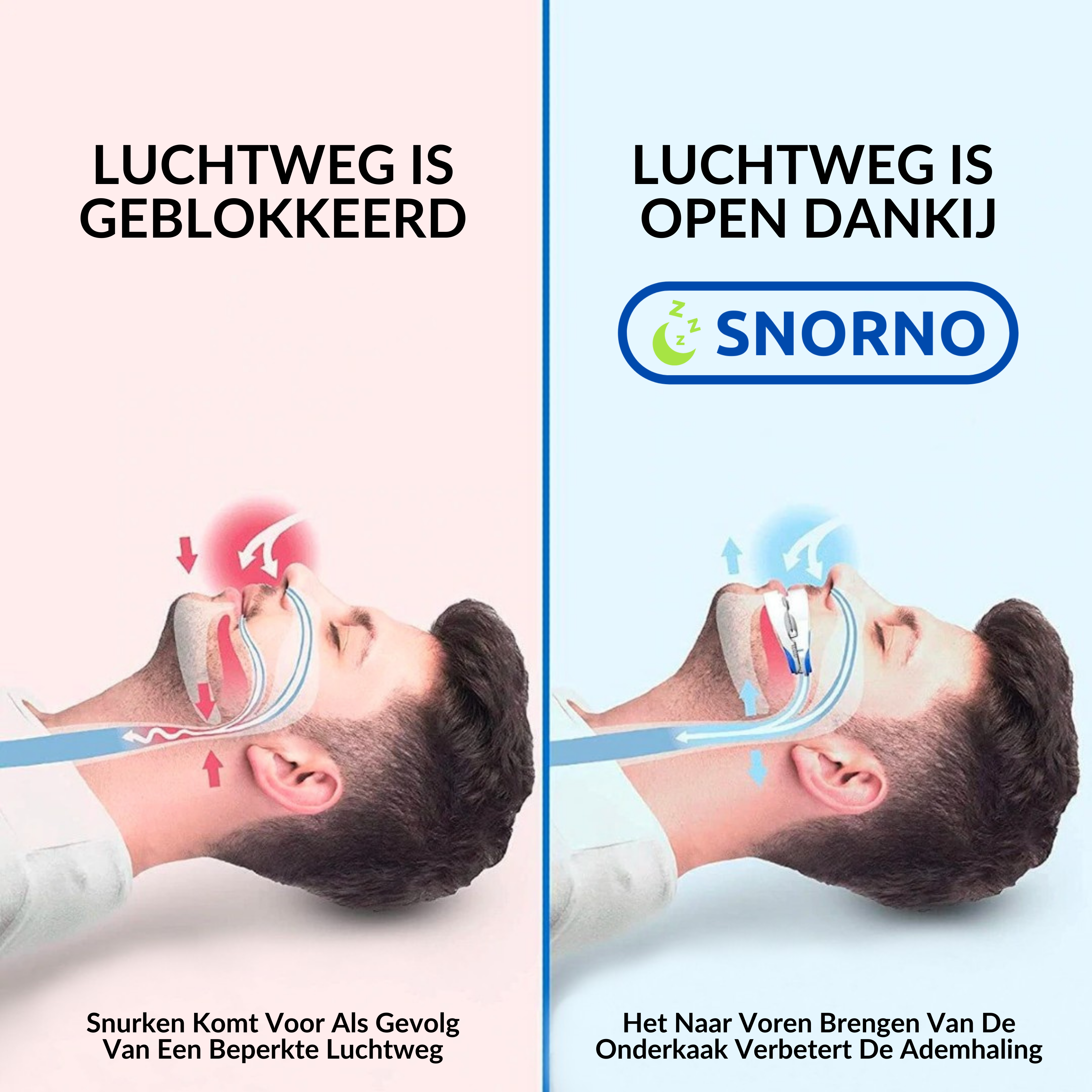 Attelle anti-ronflement SNORNO