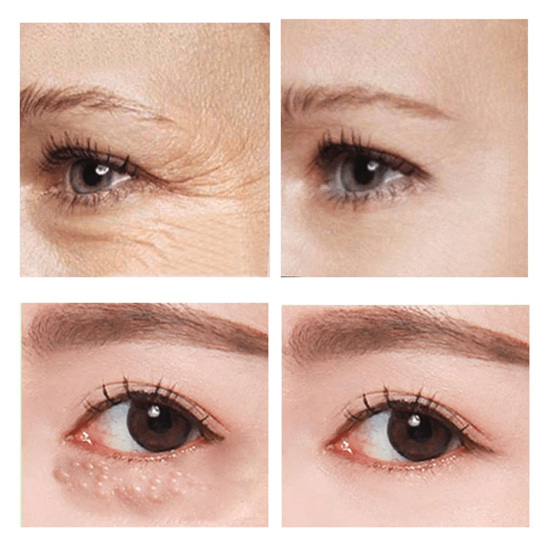 Eye Fix Crème raffermissante pour les yeux à action rapide (1+1 GRATUIT)