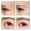 Eye Fix Crème raffermissante pour les yeux à action rapide (1+1 GRATUIT)